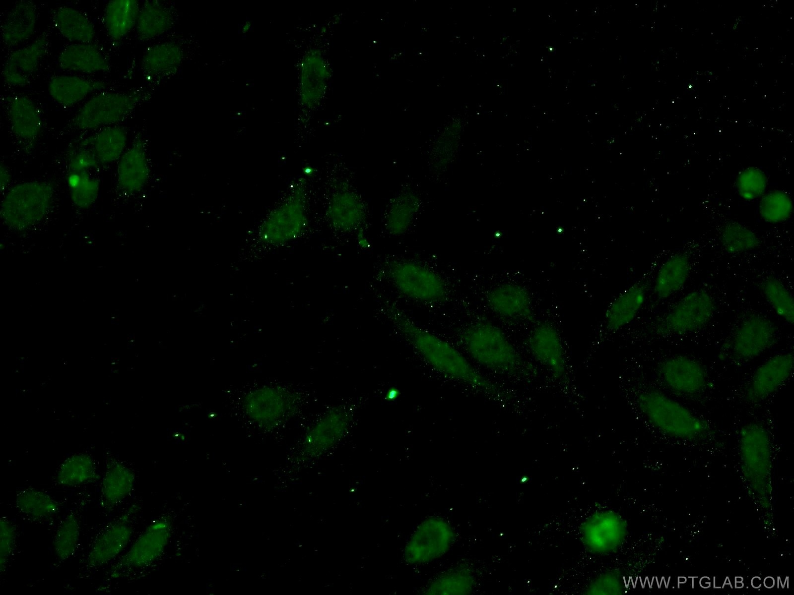 Immunofluorescence (IF) / fluorescent staining of HepG2 cells using INTS11 Polyclonal antibody (15860-1-AP)