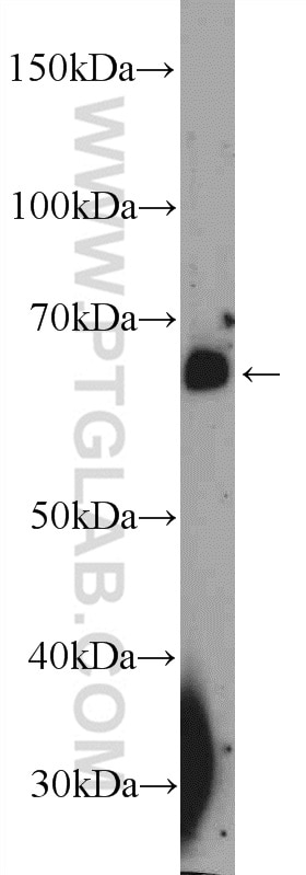 Western Blot (WB) analysis of mouse spleen tissue using INTS11 Polyclonal antibody (15860-1-AP)