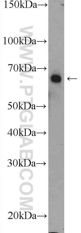 Western Blot (WB) analysis of mouse colon tissue using INTS11 Polyclonal antibody (15860-1-AP)