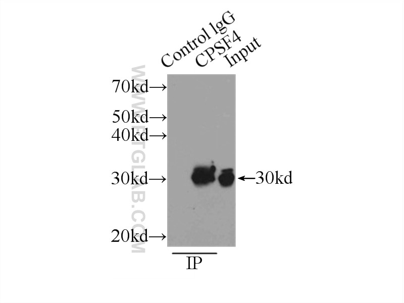 IP experiment of HeLa using 15023-1-AP