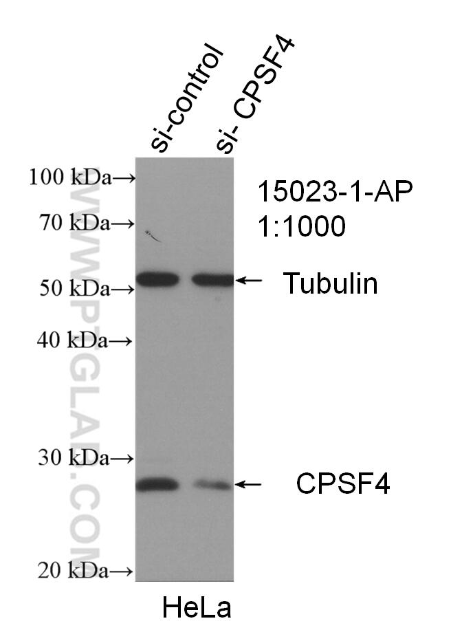Western Blot (WB) analysis of HEK-293 cells using CPSF4 Polyclonal antibody (15023-1-AP)