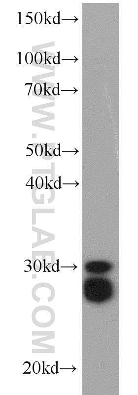 Western Blot (WB) analysis of Jurkat cells using CPSF4 Polyclonal antibody (15023-1-AP)