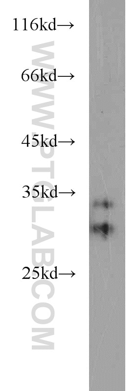 Western Blot (WB) analysis of HeLa cells using CPSF4 Polyclonal antibody (15023-1-AP)