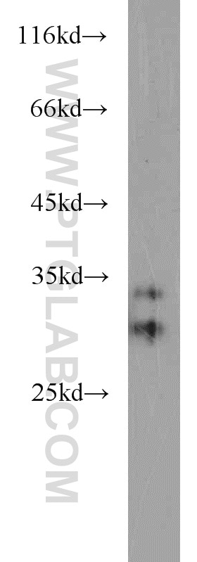 WB analysis of HeLa using 15023-1-AP