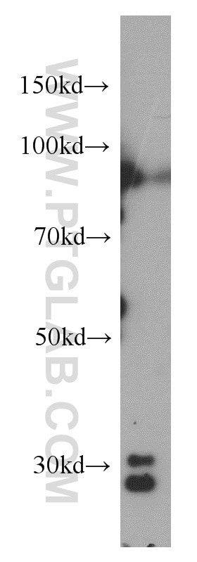 Western Blot (WB) analysis of HeLa cells using CPSF4 Polyclonal antibody (15023-1-AP)