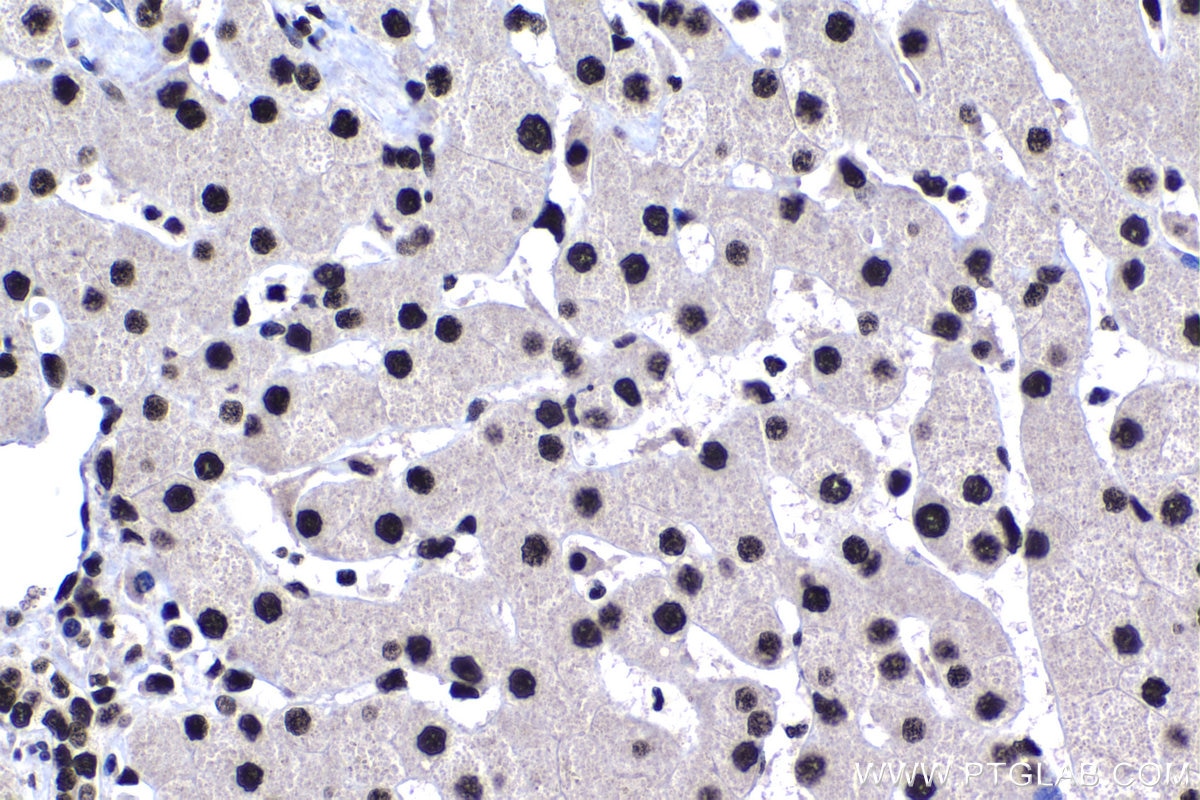 Immunohistochemistry (IHC) staining of human liver tissue using CPSF6 Polyclonal antibody (15489-1-AP)