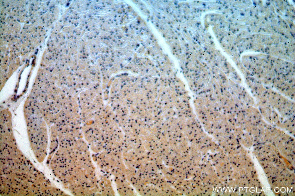 Immunohistochemistry (IHC) staining of human heart tissue using CPSF6 Polyclonal antibody (15489-1-AP)