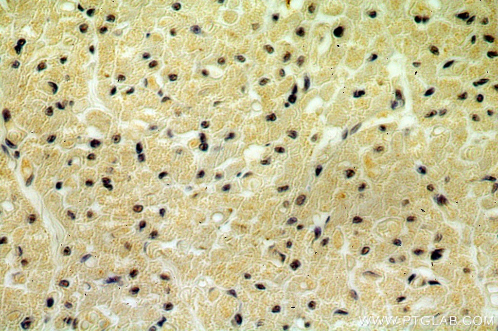 Immunohistochemistry (IHC) staining of human heart tissue using CPSF6 Polyclonal antibody (15489-1-AP)