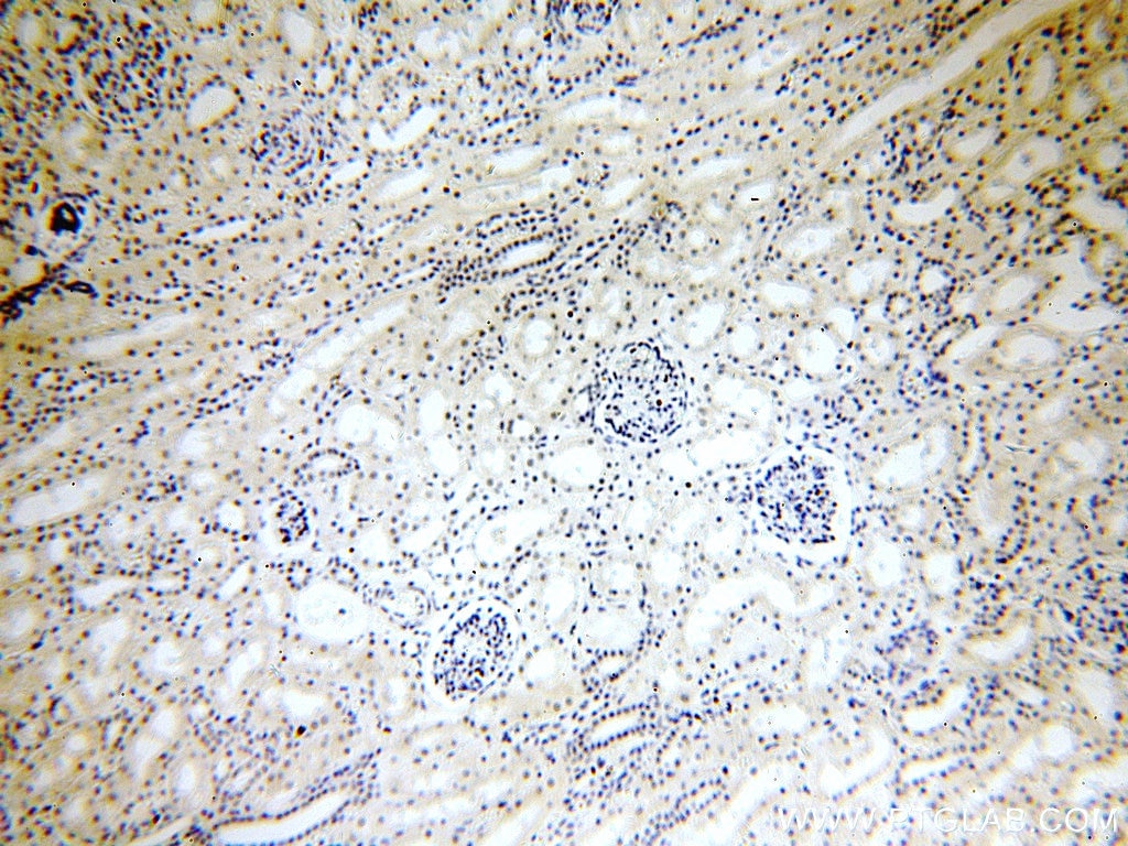 Immunohistochemistry (IHC) staining of human kidney tissue using CPSF6 Polyclonal antibody (15489-1-AP)