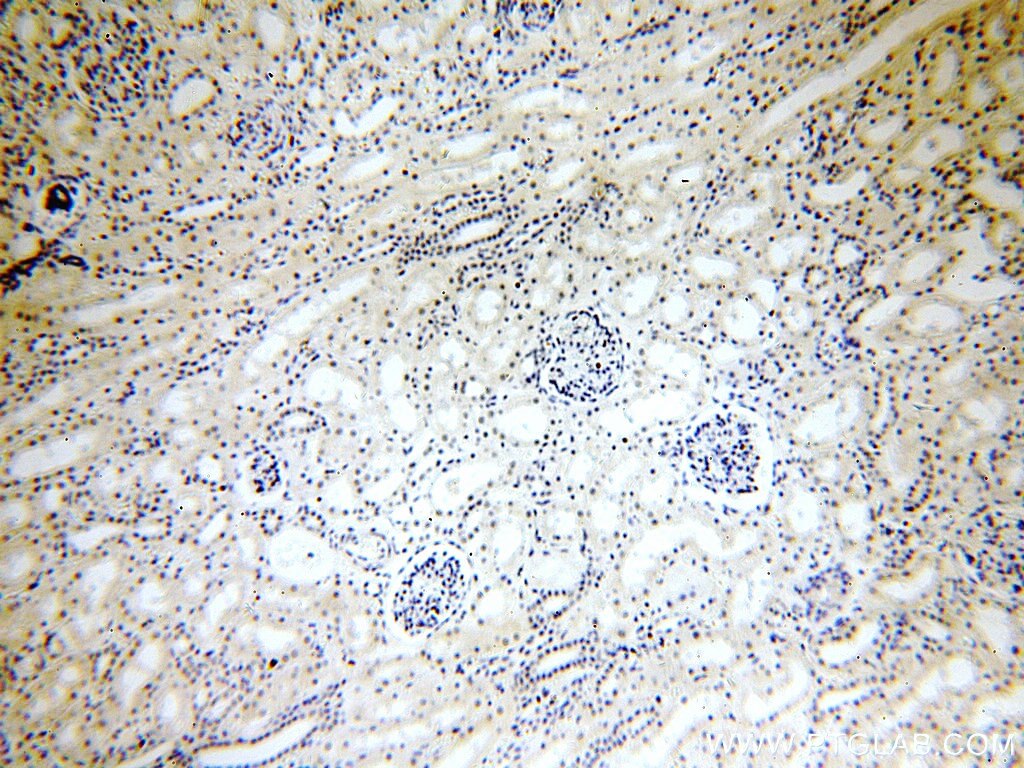 IHC staining of human kidney using 15489-1-AP