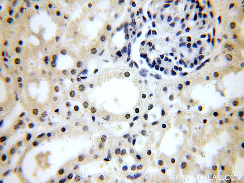 Immunohistochemistry (IHC) staining of human kidney tissue using CPSF6 Polyclonal antibody (15489-1-AP)