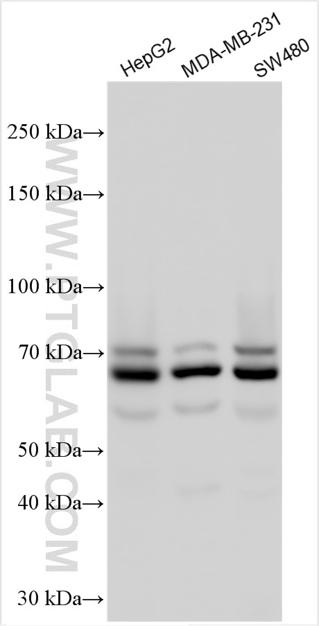 Western Blot (WB) analysis of various lysates using CPSF6 Polyclonal antibody (15489-1-AP)
