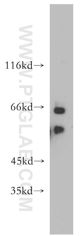 CPSF6 Polyclonal antibody