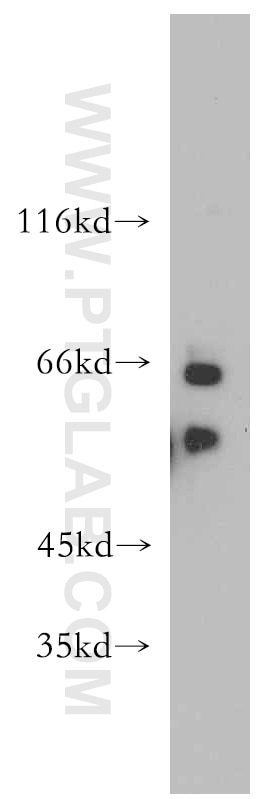 Western Blot (WB) analysis of HeLa cells using CPSF6 Polyclonal antibody (15489-1-AP)