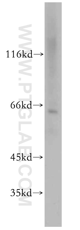 Western Blot (WB) analysis of Jurkat cells using CPSF6 Polyclonal antibody (15489-1-AP)