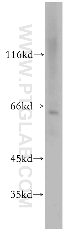 WB analysis of Jurkat using 15489-1-AP