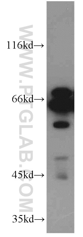 Western Blot (WB) analysis of Jurkat cells using CPSF6 Polyclonal antibody (15489-1-AP)