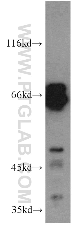 Western Blot (WB) analysis of Jurkat cells using CPSF6 Polyclonal antibody (15489-1-AP)