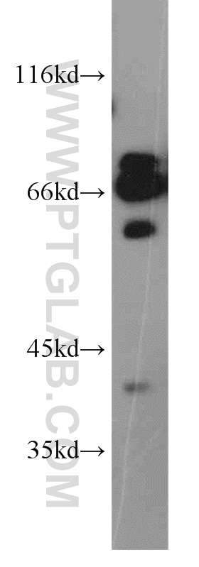 Western Blot (WB) analysis of HeLa cells using CPSF6 Polyclonal antibody (15489-1-AP)