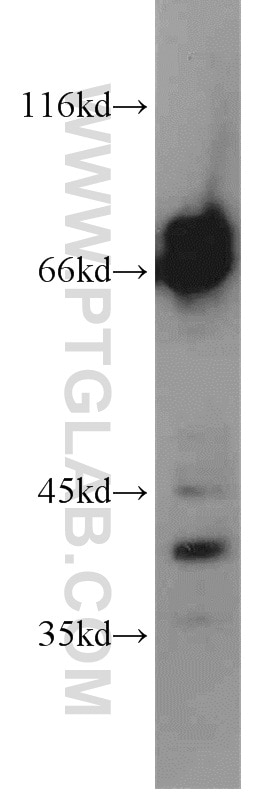 Western Blot (WB) analysis of HeLa cells using CPSF6 Polyclonal antibody (15489-1-AP)