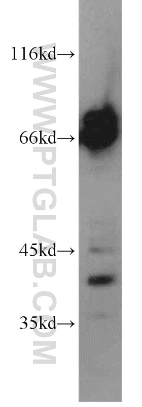 WB analysis of HeLa using 15489-1-AP