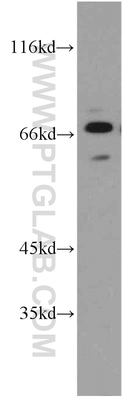 Western Blot (WB) analysis of PC-3 cells using CPSF6 Polyclonal antibody (15489-1-AP)