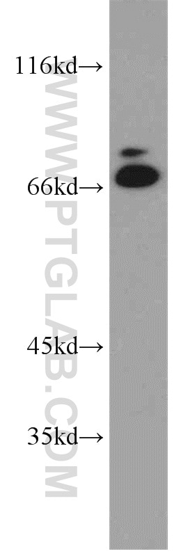 Western Blot (WB) analysis of PC-3 cells using CPSF6 Polyclonal antibody (15489-1-AP)