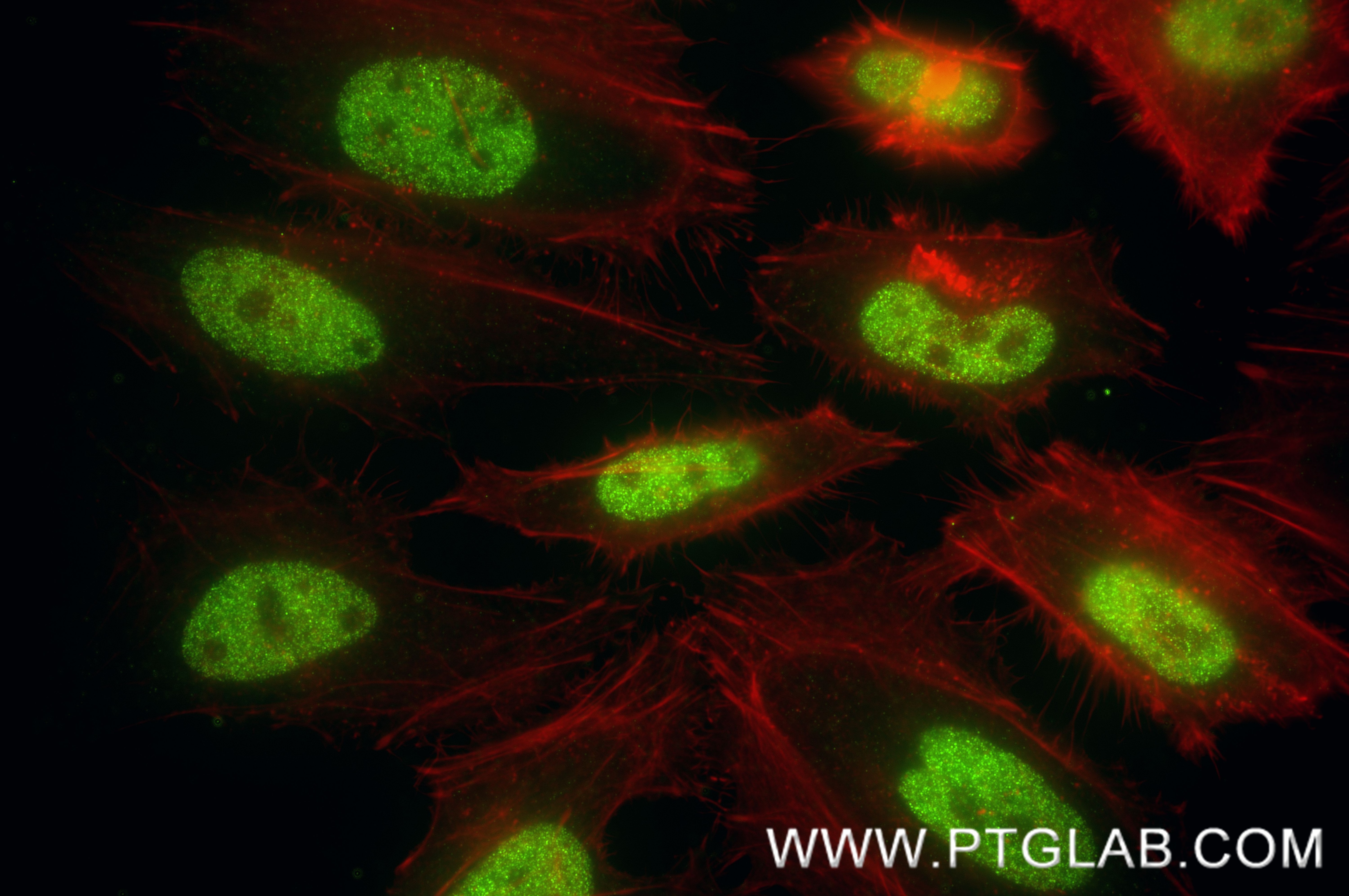 IF Staining of HeLa using 88362-1-RR (same clone as 88362-1-PBS) Immunofluorescence (IF) / fluorescent staining of HeLa cells using CPSF6 Recombinant monoclonal antibody (88362-1-RR)