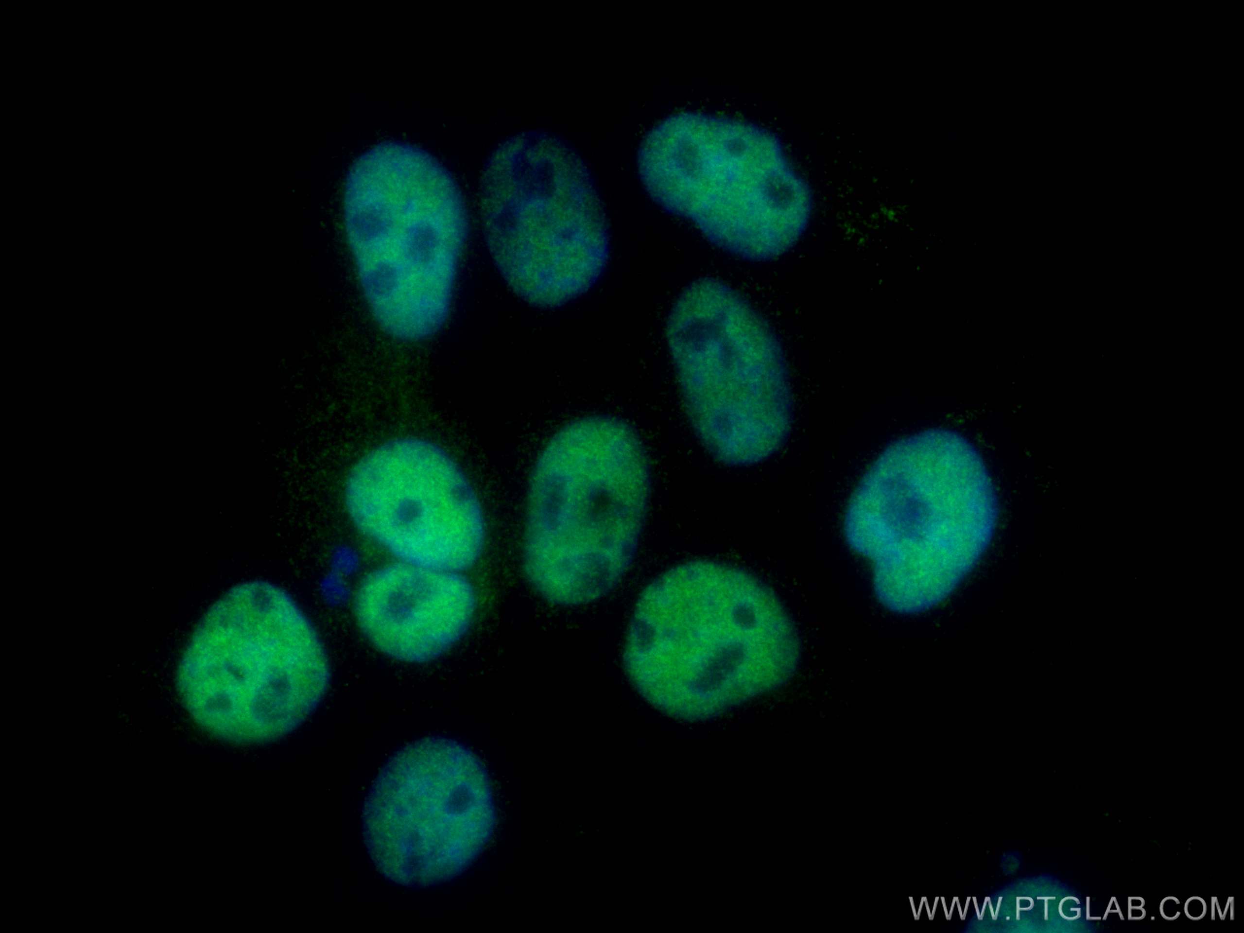 Immunofluorescence (IF) / fluorescent staining of A431 cells using CPSF7 Polyclonal antibody (55195-1-AP)