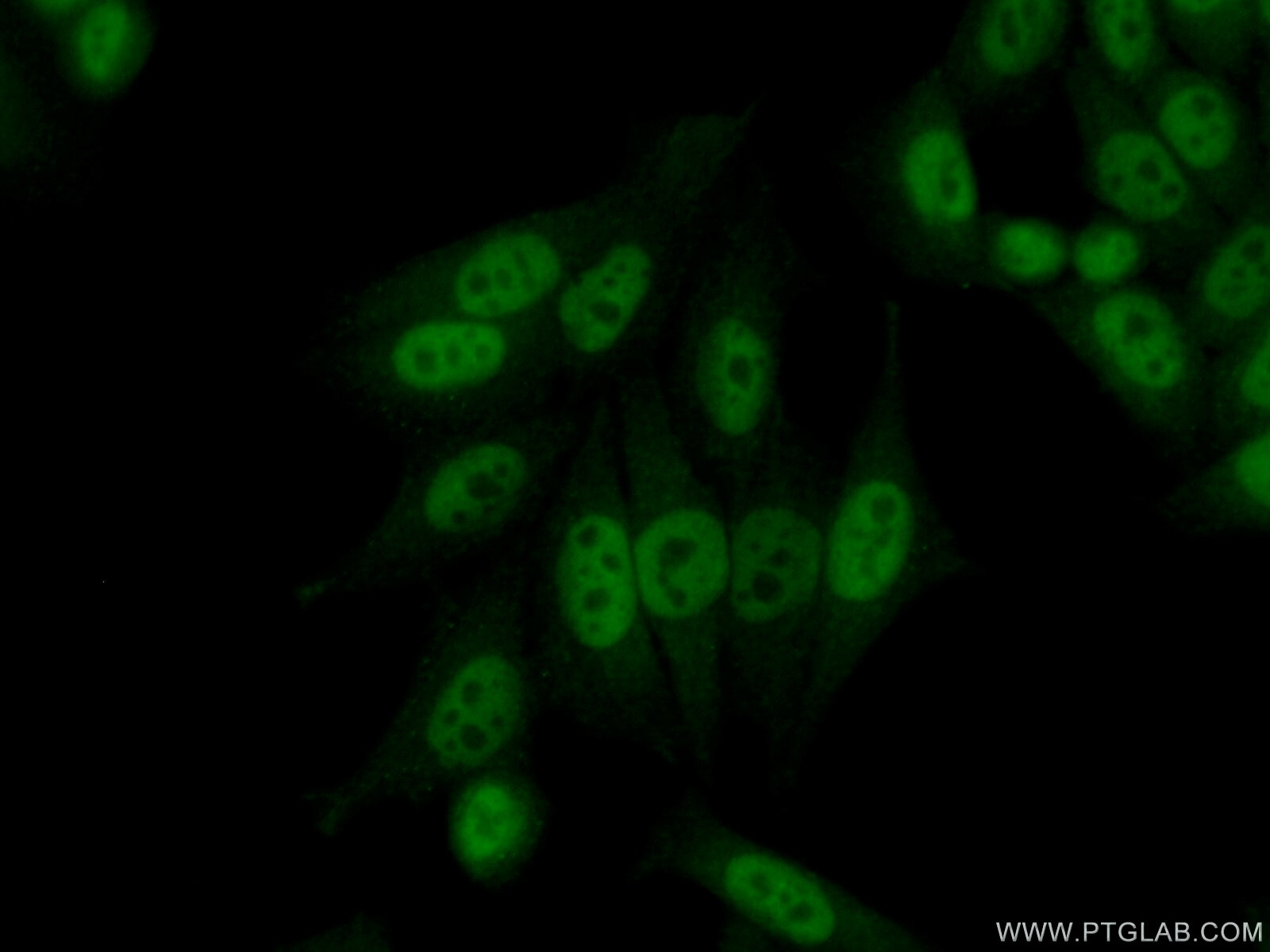 Immunofluorescence (IF) / fluorescent staining of HeLa cells using CPSF7 Polyclonal antibody (55195-1-AP)