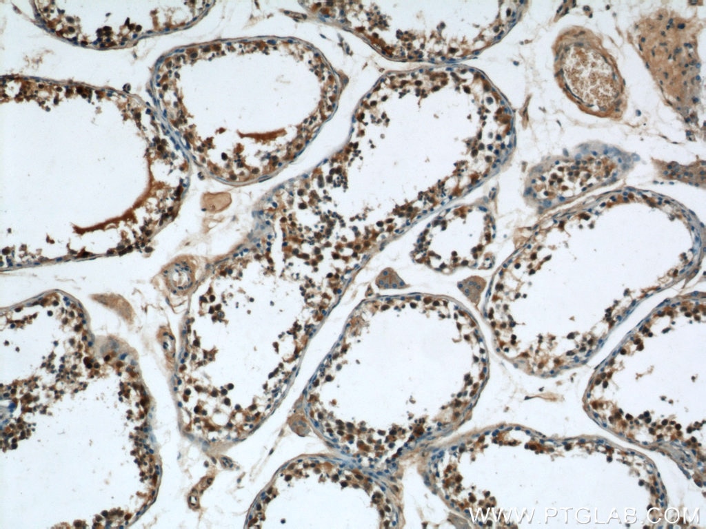 Immunohistochemistry (IHC) staining of human testis tissue using CPSF7 Polyclonal antibody (55195-1-AP)