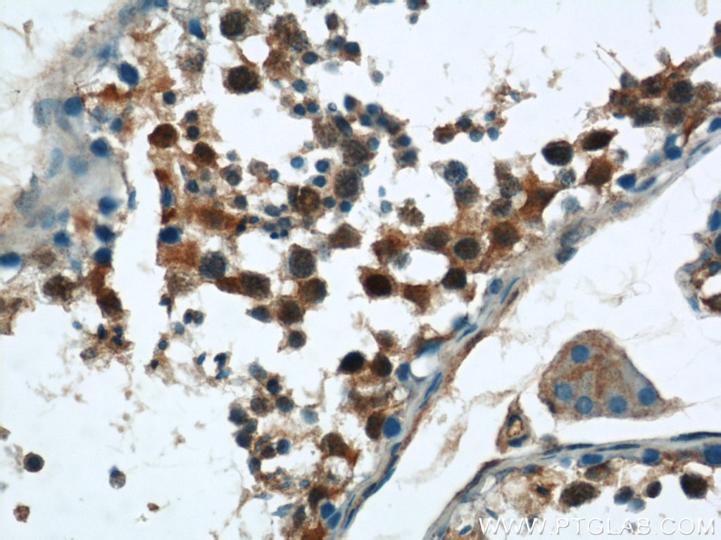 Immunohistochemistry (IHC) staining of human testis tissue using CPSF7 Polyclonal antibody (55195-1-AP)