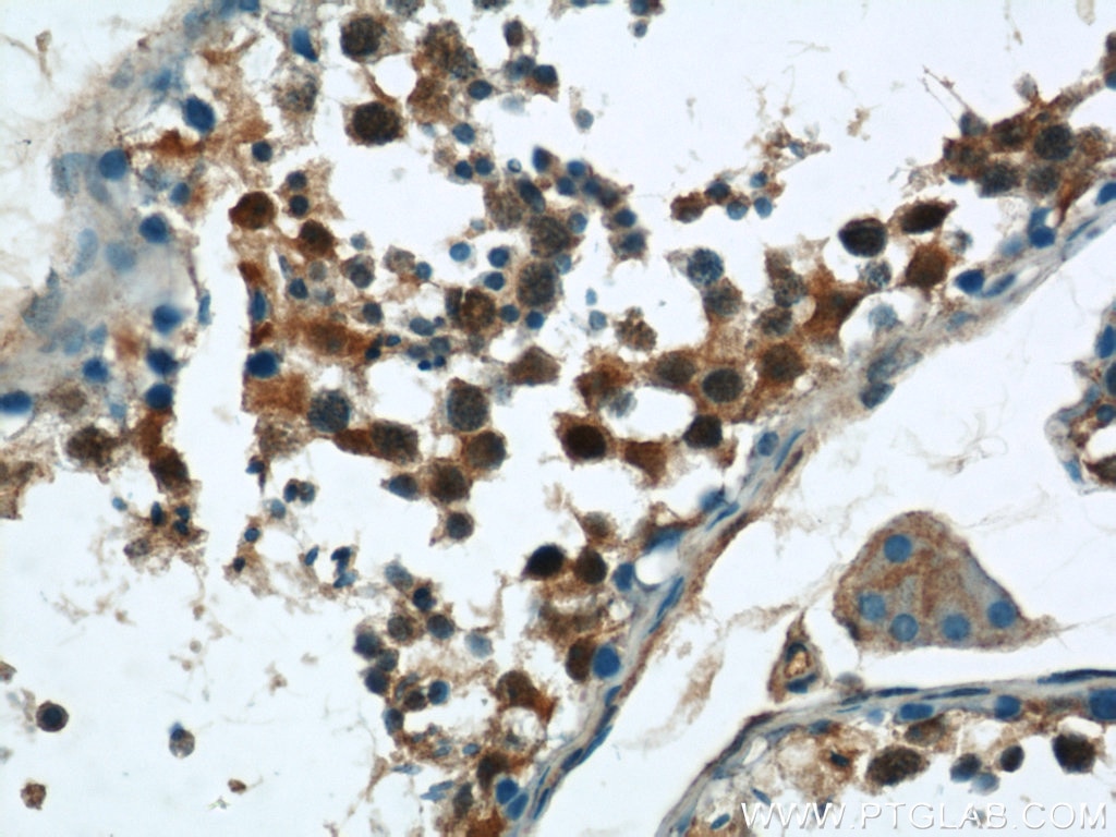 IHC staining of human testis using 55195-1-AP