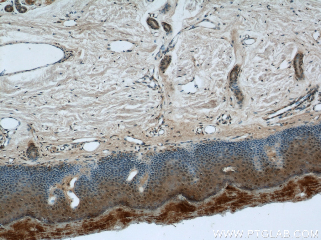 Immunohistochemistry (IHC) staining of human skin tissue using CPSF7 Polyclonal antibody (55195-1-AP)