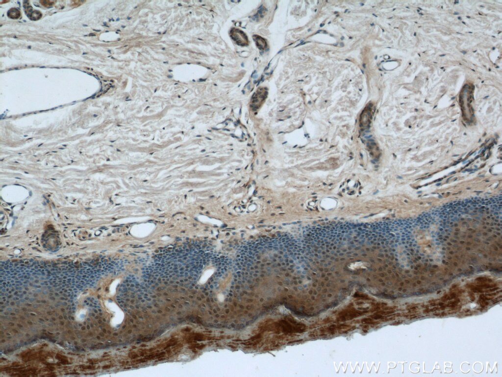 Immunohistochemistry (IHC) staining of human skin tissue using CPSF7 Polyclonal antibody (55195-1-AP)