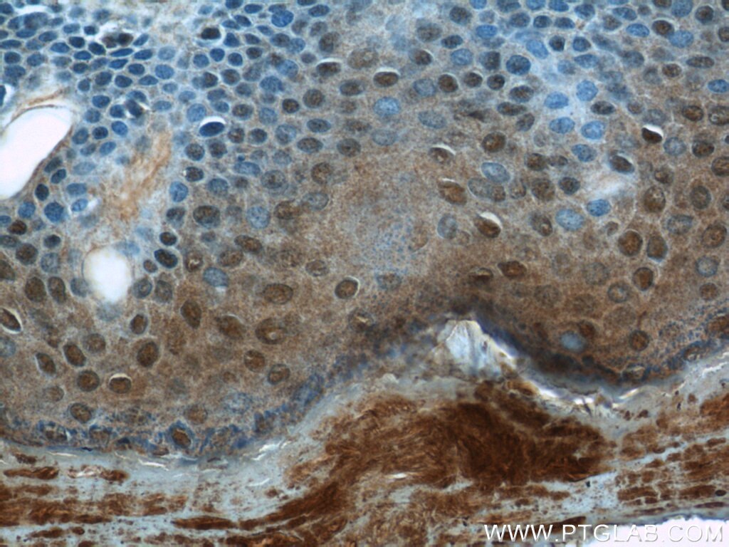 Immunohistochemistry (IHC) staining of human skin tissue using CPSF7 Polyclonal antibody (55195-1-AP)