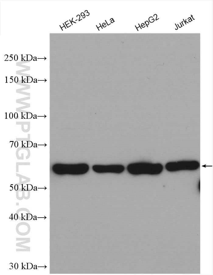 Western Blot (WB) analysis of various lysates using CPSF7 Polyclonal antibody (55195-1-AP)