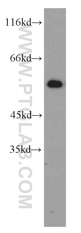 Western Blot (WB) analysis of HEK-293 cells using CPSF7 Polyclonal antibody (55195-1-AP)
