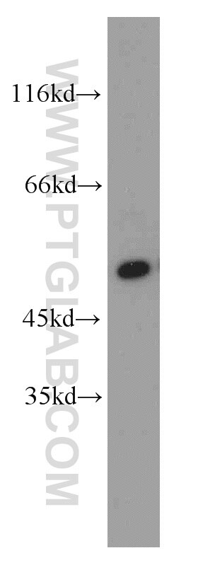 Western Blot (WB) analysis of mouse brain tissue using CPSF7 Polyclonal antibody (55195-1-AP)