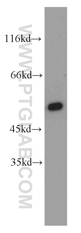 Western Blot (WB) analysis of mouse brain tissue using CPSF7 Polyclonal antibody (55195-1-AP)