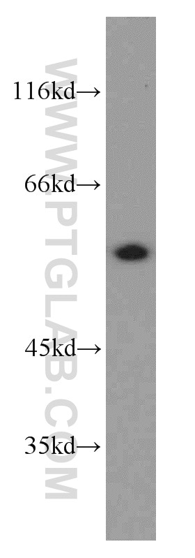 Western Blot (WB) analysis of HeLa cells using CPSF7 Polyclonal antibody (55195-1-AP)