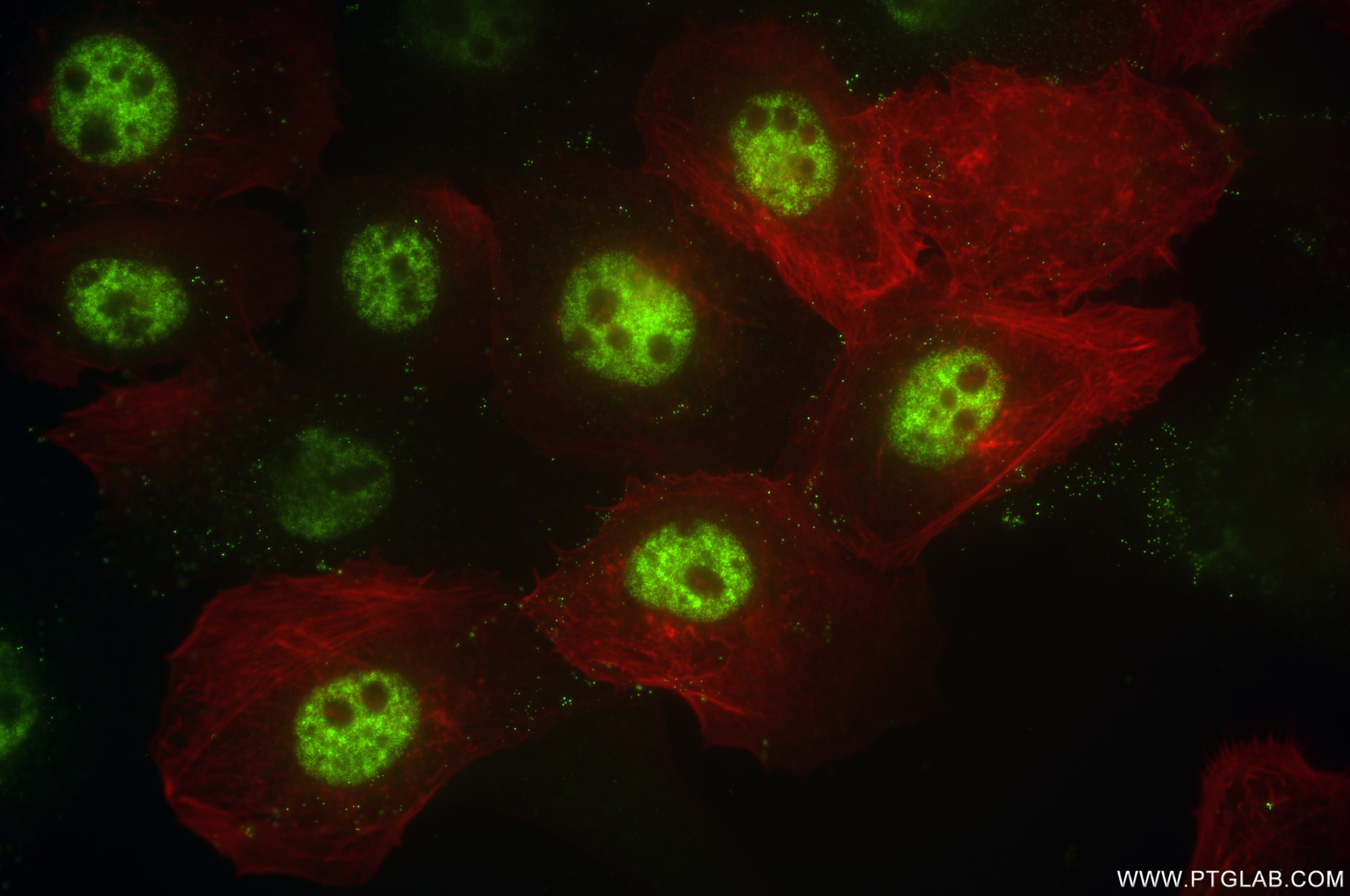 Immunofluorescence (IF) / fluorescent staining of A431 cells using CPSF7 Recombinant antibody (85203-1-RR)
