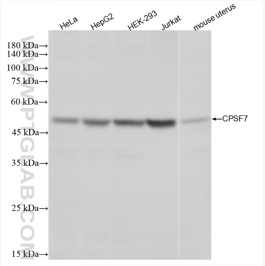 Western Blot (WB) analysis of various lysates using CPSF7 Recombinant antibody (85203-1-RR)