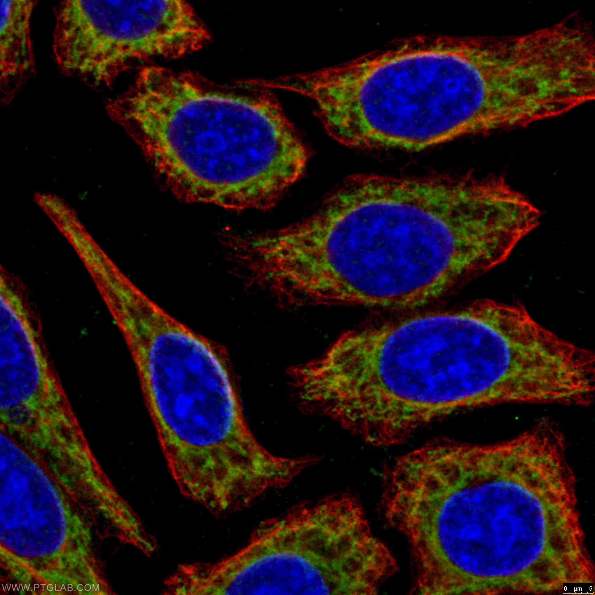 Immunofluorescence (IF) / fluorescent staining of HepG2 cells using CPT1A Polyclonal antibody (15184-1-AP)