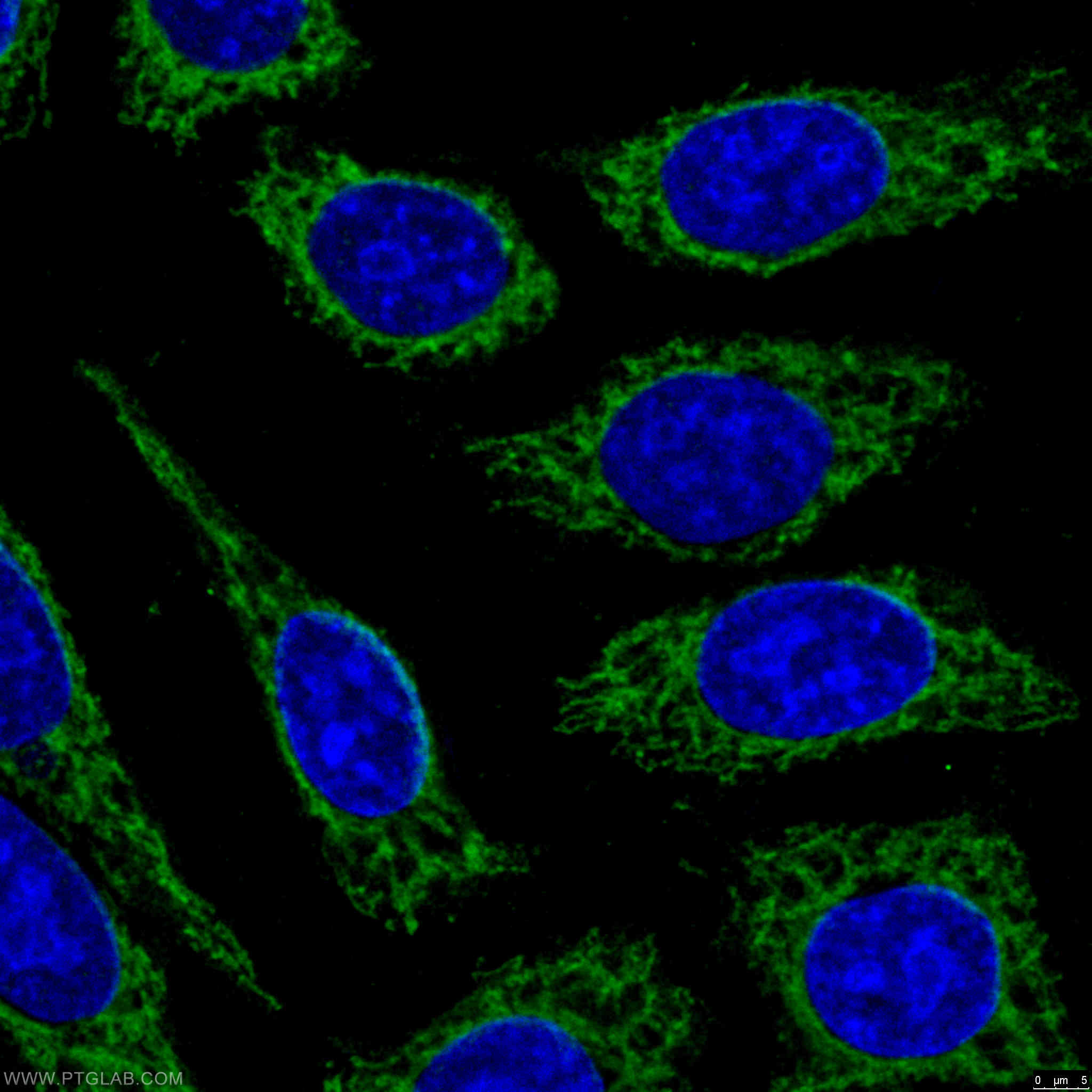 Immunofluorescence (IF) / fluorescent staining of HepG2 cells using CPT1A Polyclonal antibody (15184-1-AP)