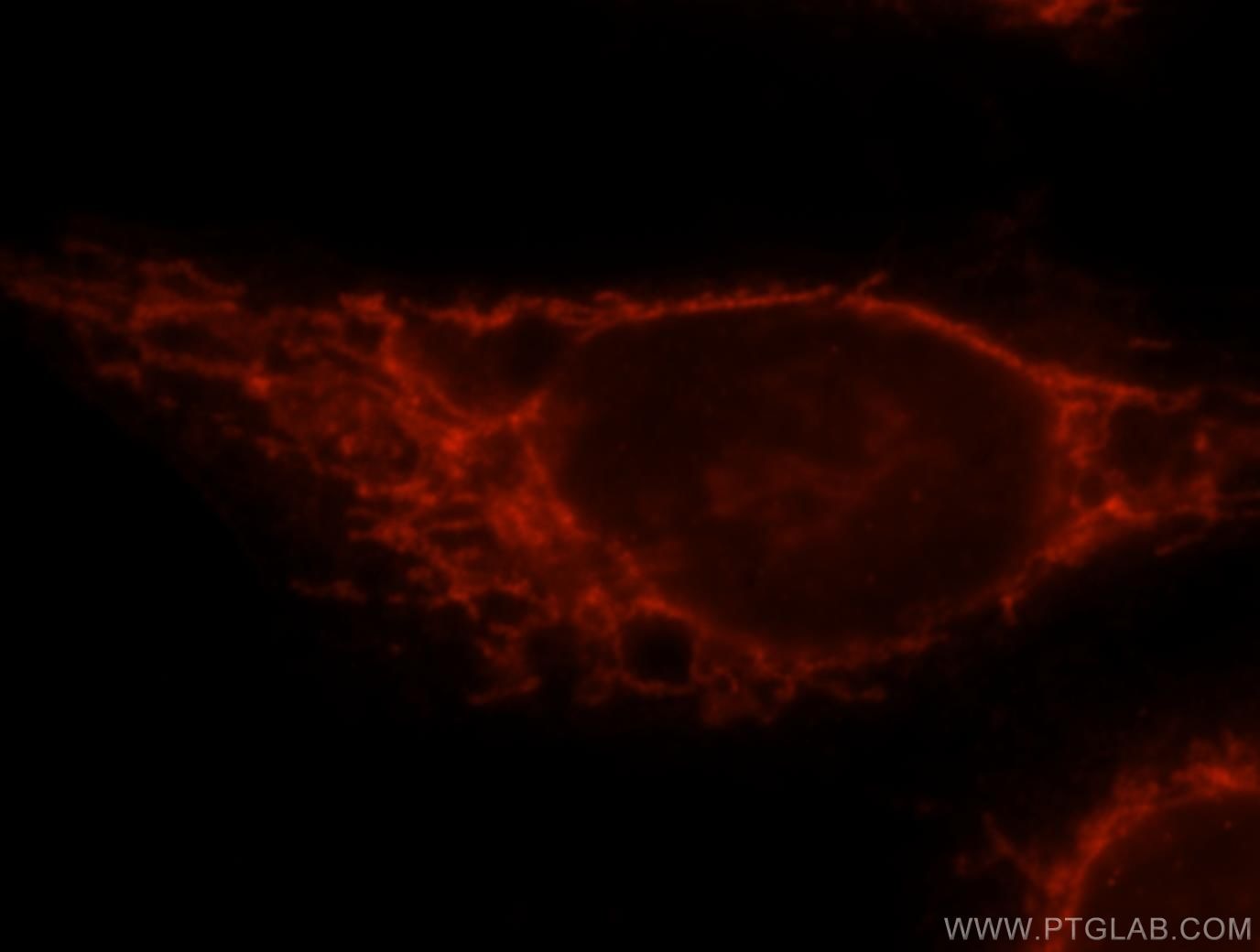 IF Staining of HeLa using 15184-1-AP