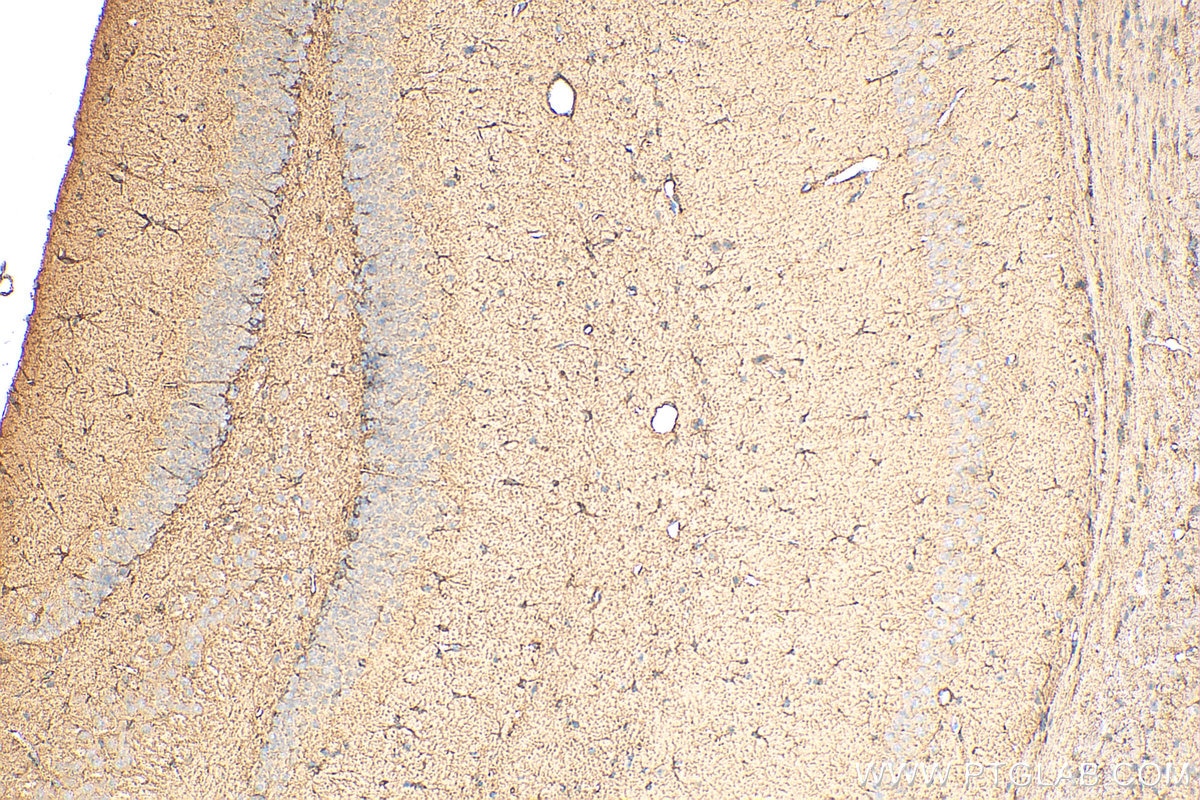 Immunohistochemistry (IHC) staining of mouse brain tissue using CPT1A Polyclonal antibody (15184-1-AP)