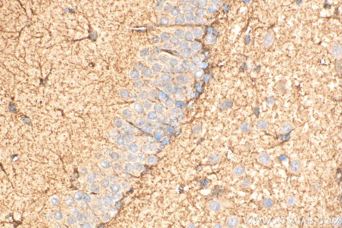 Immunohistochemistry (IHC) staining of mouse brain tissue using CPT1A Polyclonal antibody (15184-1-AP)