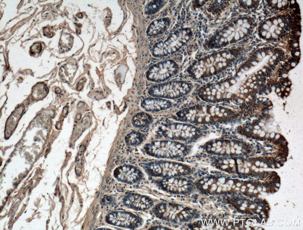 IHC staining of human colon using 15184-1-AP