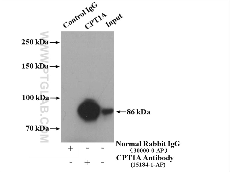 Immunoprecipitation (IP) experiment of HepG2 cells using CPT1A Polyclonal antibody (15184-1-AP)